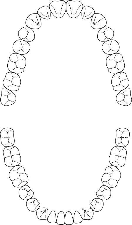 歯式図8