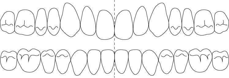 歯式図11